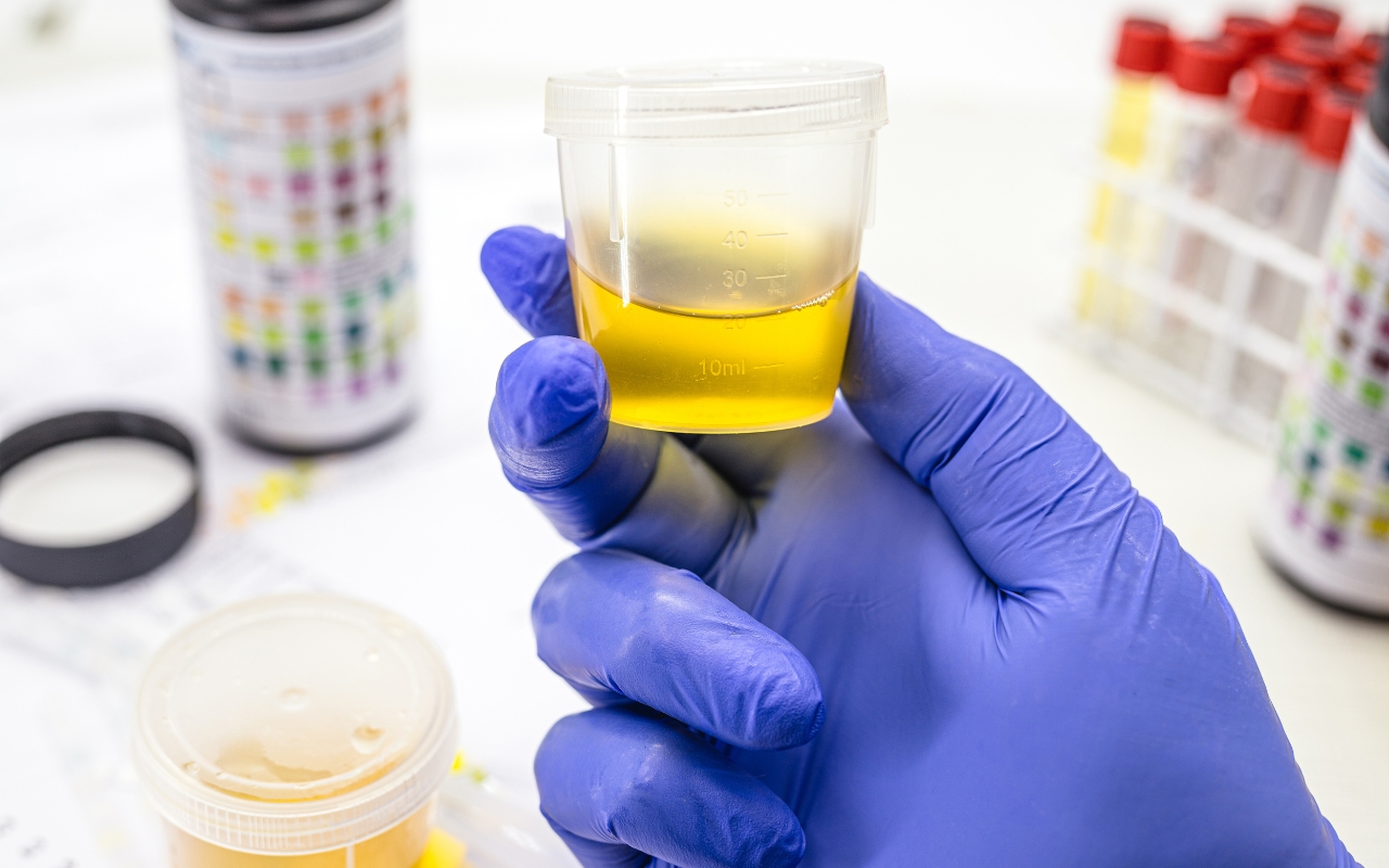 เครื่องมือตรวจสารเสพติด