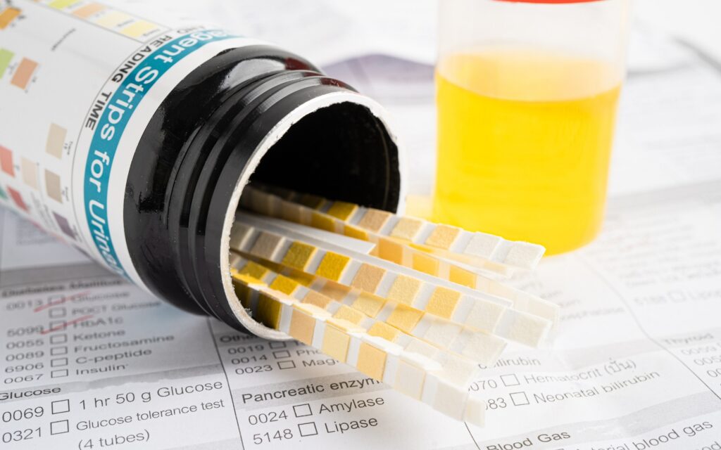 ผลตรวจคัดกรองสารเสพติดเบื้องต้น