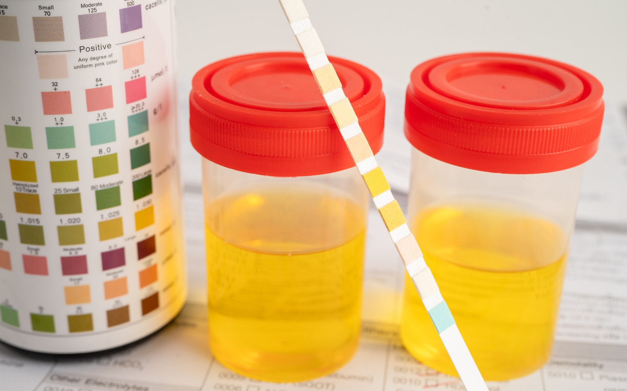 เจือจางความเข้มข้นของปัสสาวะ