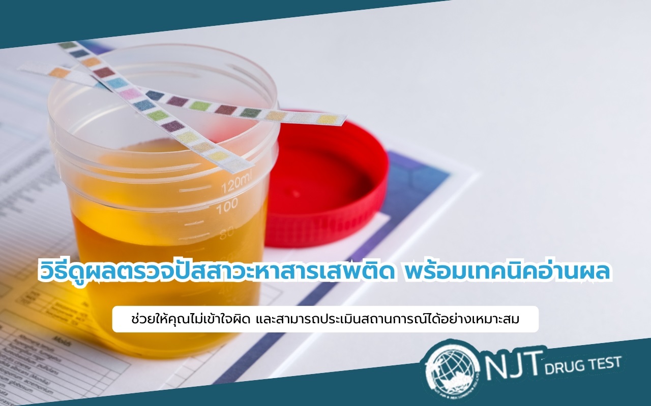 วิธีดูผลตรวจปัสสาวะ